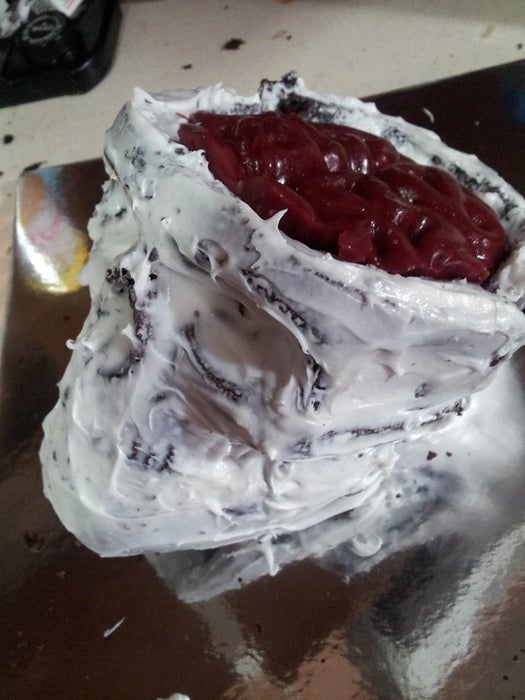 脑移植手术其实不难